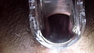 Cum Cervix Insemination