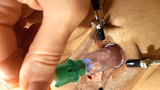 A Pump, a Vibrator, and the Clitoris Bring Her to Orgasm