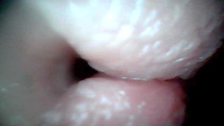 Endoscope Camera Captures Moment of Male Ejaculation 4K