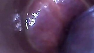 Endoscope POV Test Tube Cock Urethral Insertion