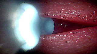 I couldn't believe what happens INSIDE the penis as sperm passes through (endoscopic footage)