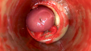Camera Inside Deep Pussy Captures Huge Ejaculation of Sperm Asmr